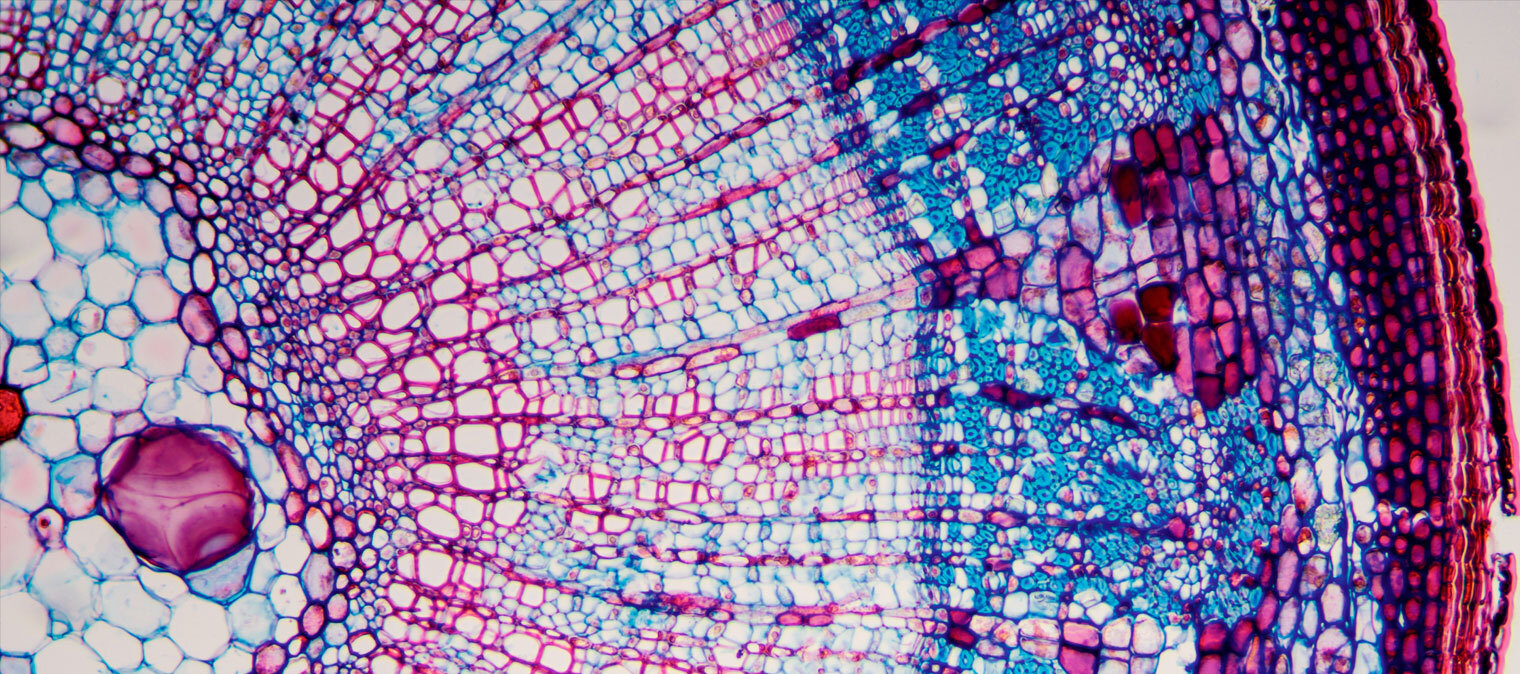 5 Examples Of Cellular Stress